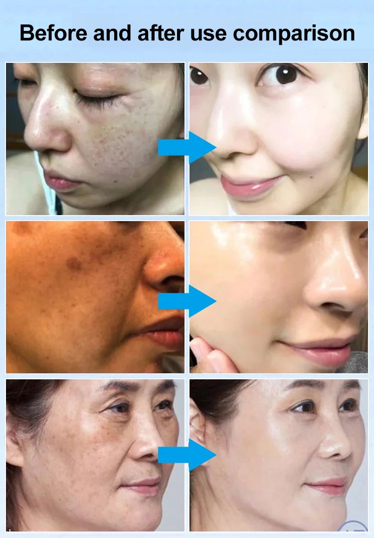 MegaMall™ | Spot Fading Urea Cream