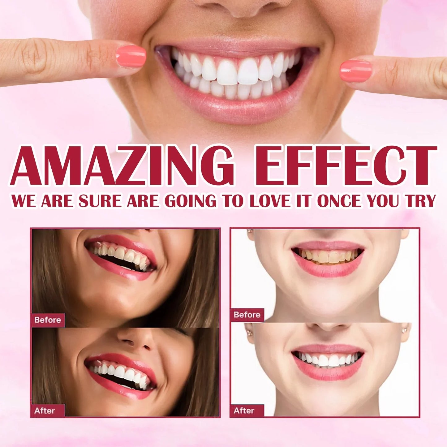 Yayashi SP4 Oral Care Probiotic Whitening Toothpaste 120g β Shine Brighter, Remove Years of Coffee, Tea & Smoking Stains