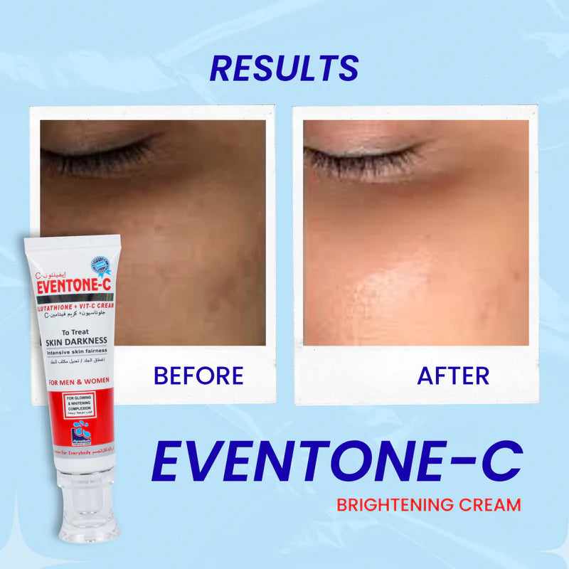 MegaMall™ | Eventone C Cream ( Skin whitening )