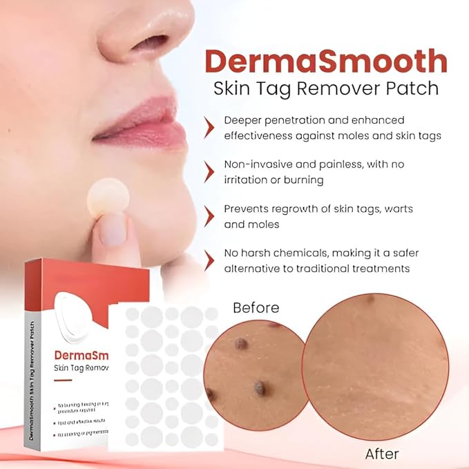MegaMall™ | Skin Tags Remover Patch