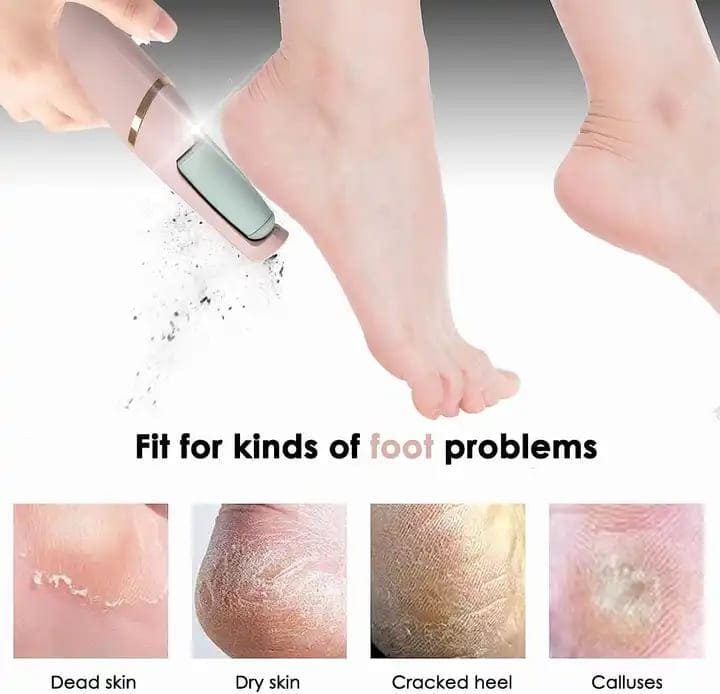 MegaMall™ | Electric Foot Callus Remover – Rechargeable