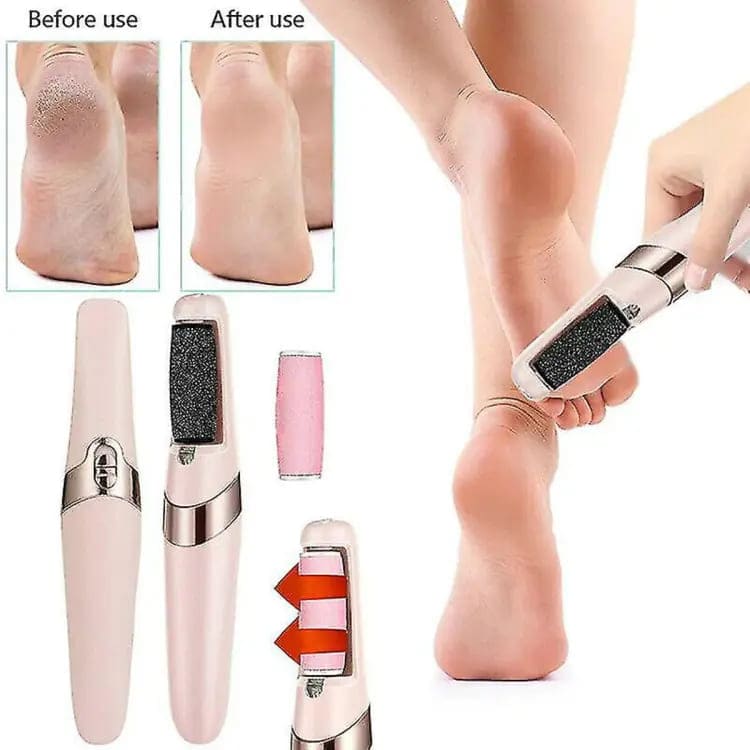 MegaMall™ | Electric Foot Callus Remover – Rechargeable