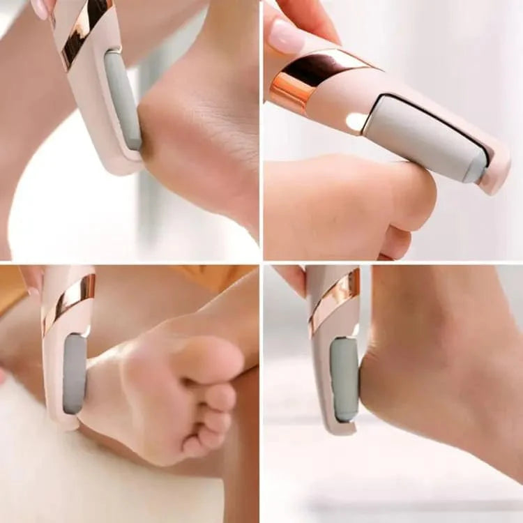 MegaMall™ | Electric Foot Callus Remover – Rechargeable