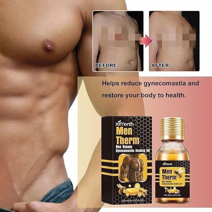 MegaMall™ | Men Therm Bee Venom Gynecomastia Heating Oil